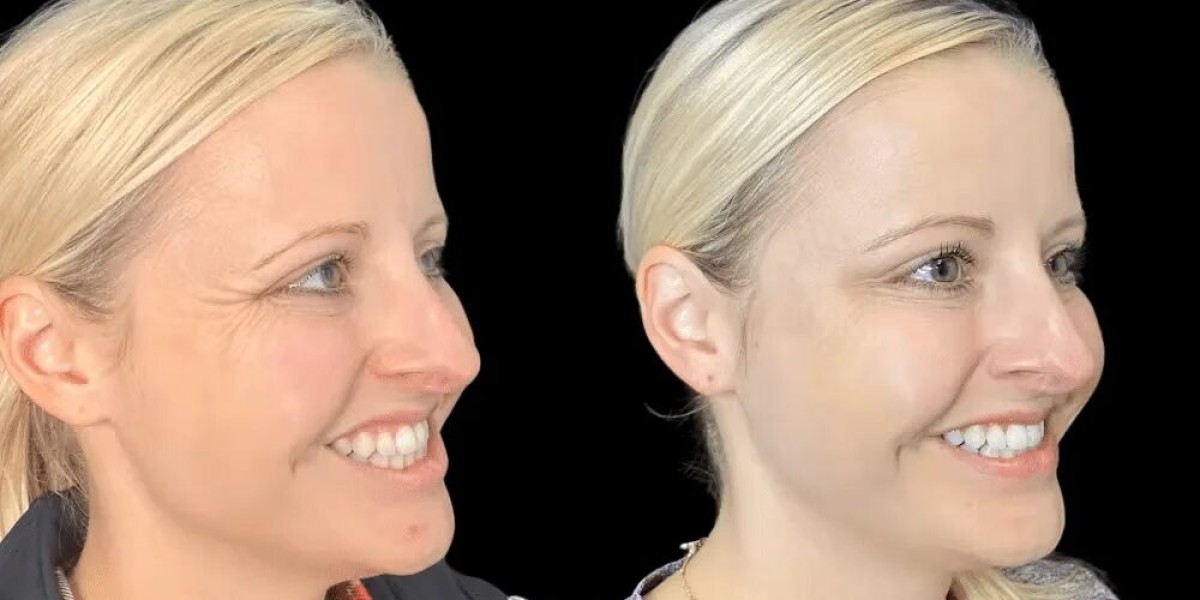 What First-Time Clients Expect at Best Aesthetic Clinic in Dubai