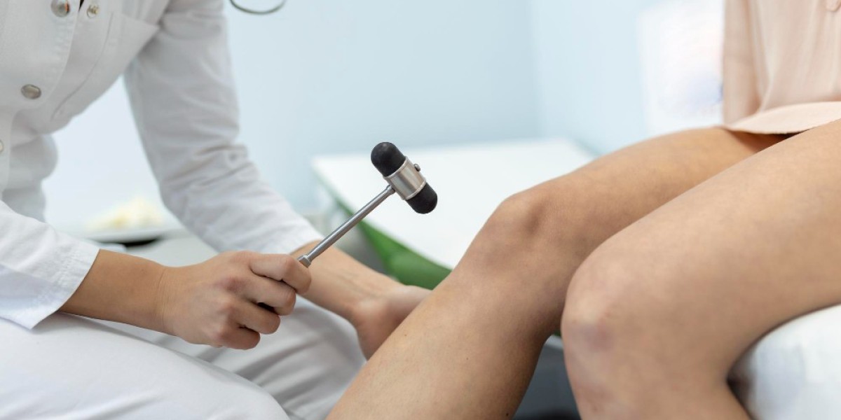 Understanding Sclerotherapy Treatment in San Antonio