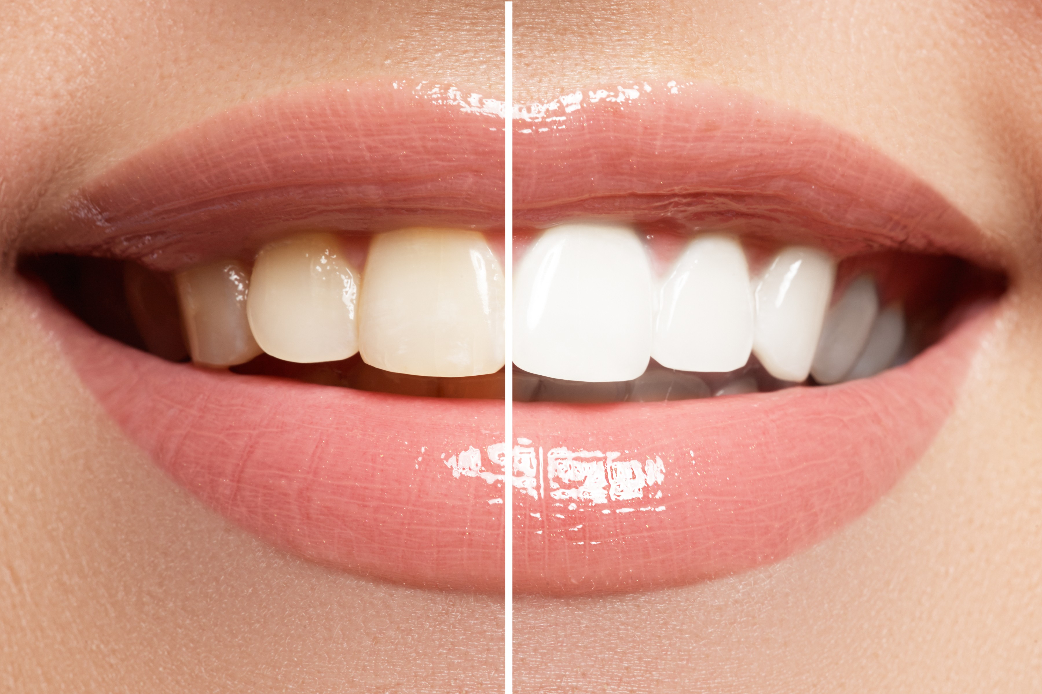 Image Source - Directory Dental Implant