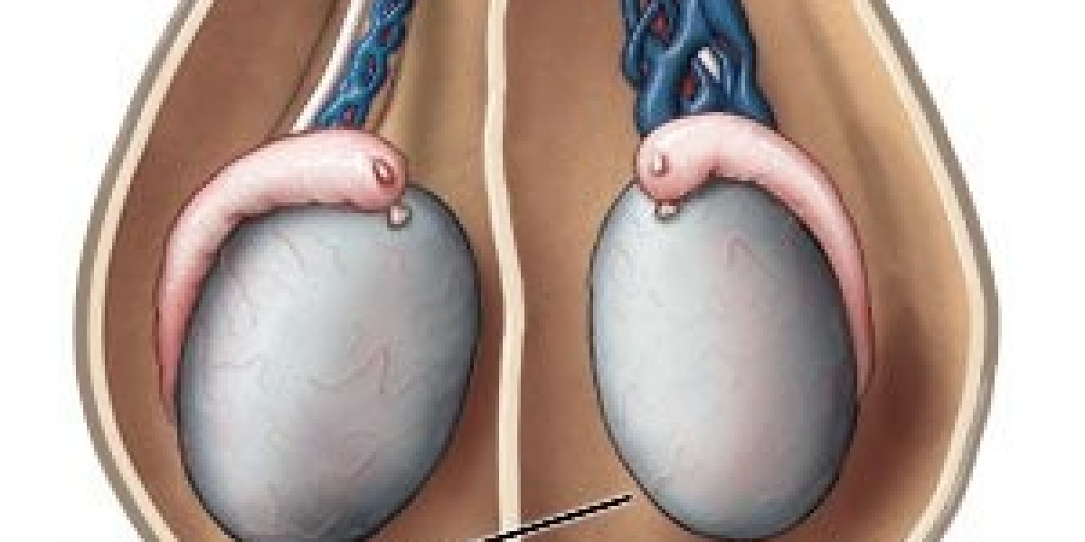 Top 7 Effective Varicocele Treatments: What Really Works in 2025