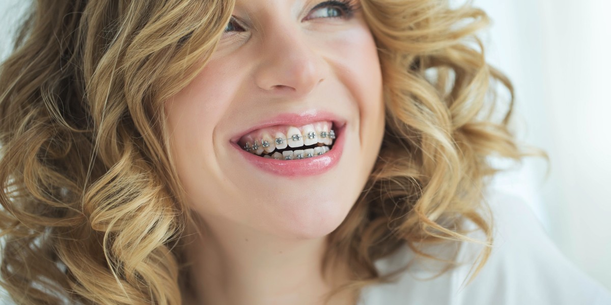Expert Help When You Need It for Your Smile in Wigan