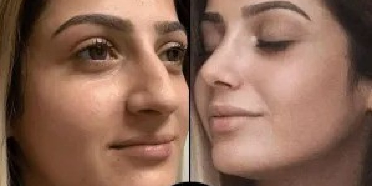 Best Doctors in Dubai for Quick Recovery Aesthetic Treatments